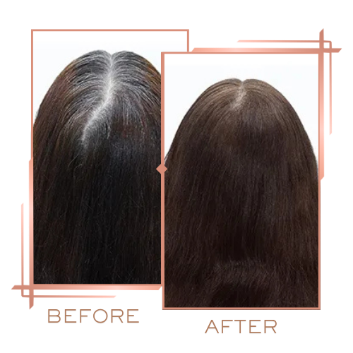 Patient before and after hair treatment for overall vitality